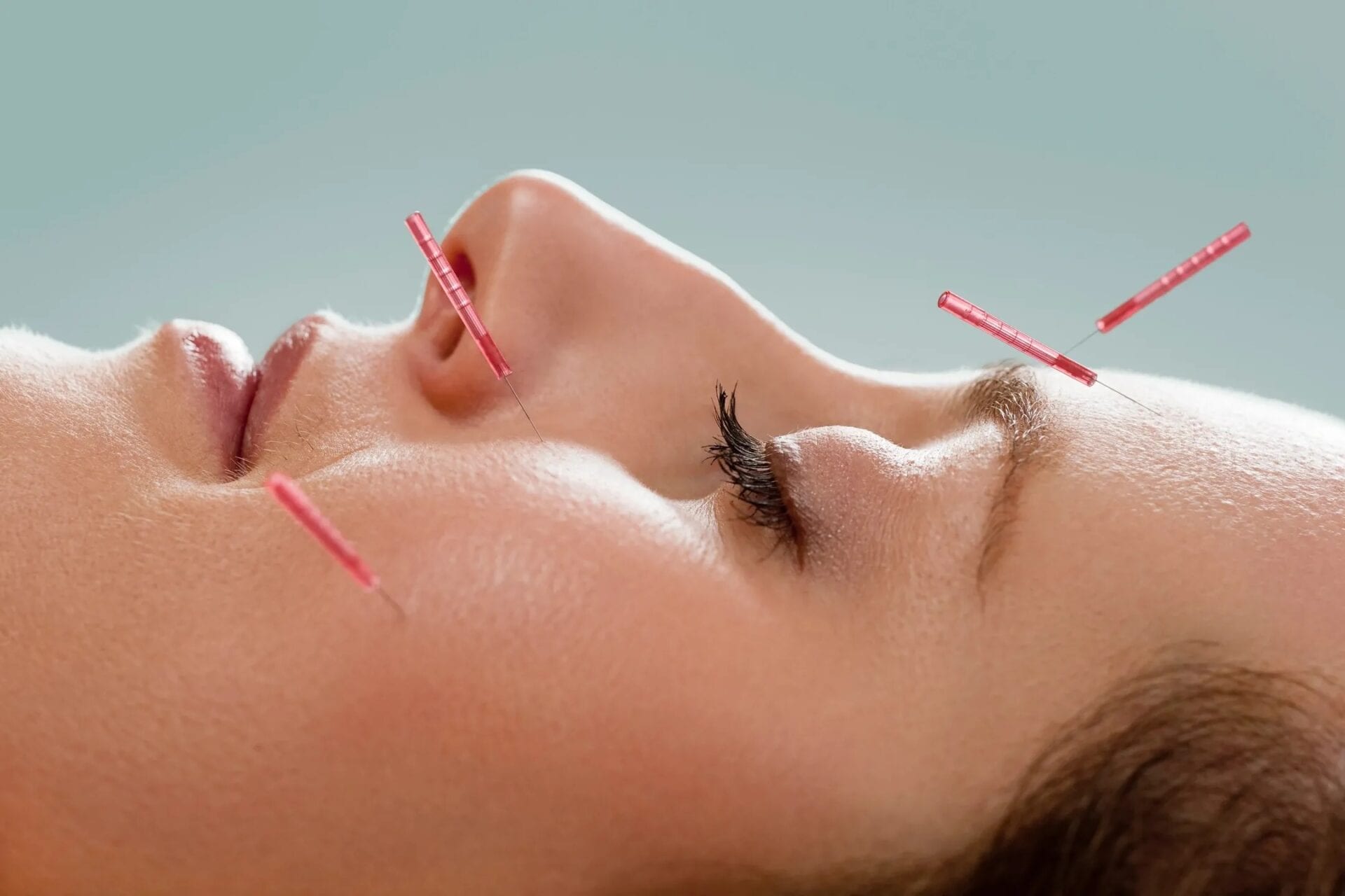 Modern-Acupuncture